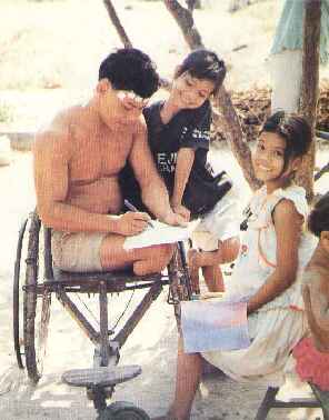 Amputee in wheelchair