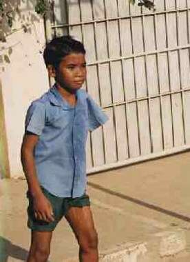 Boy with one arm at the school
