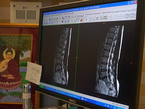 X-rays of my spine